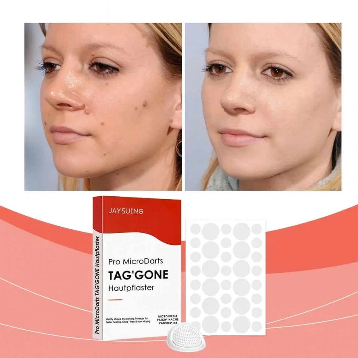 Painless Micro-Patch For Skin Tag, Mole & Wart Removal 12026003226942-1