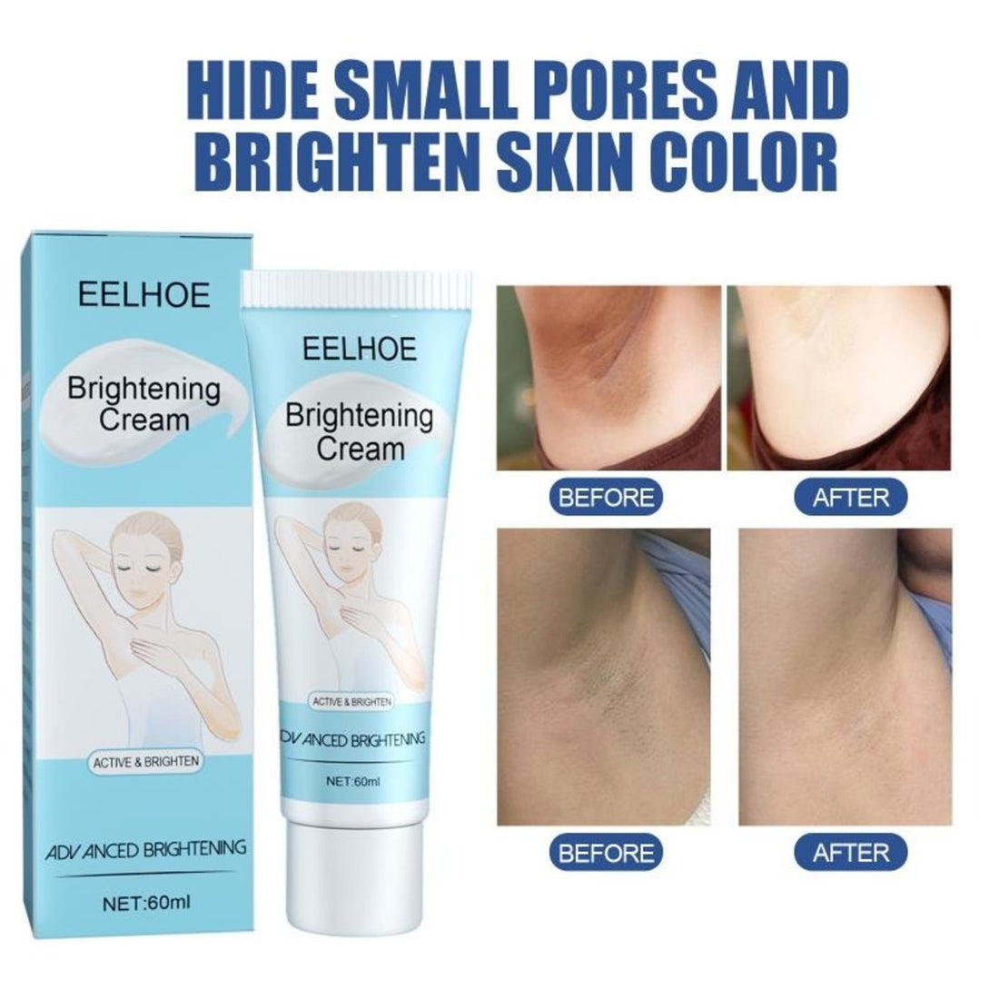 Dark Spot Whitening Body Cream for Knees, Elbows & Intimate Areas 10082387001690-1