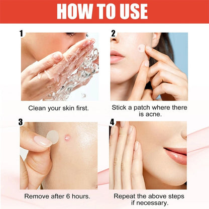 Painless Micro-Patch For Skin Tag, Mole & Wart Removal 12026003226942-1