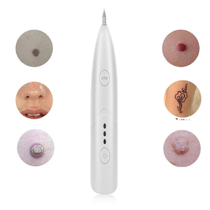 Instant Tattoo Removal Pen 250834