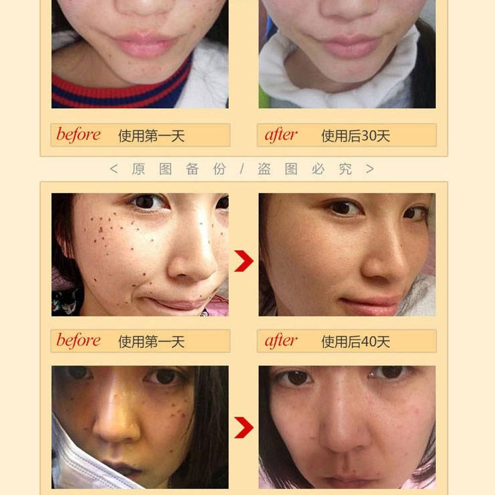Organic Skin Tag Removal Serum