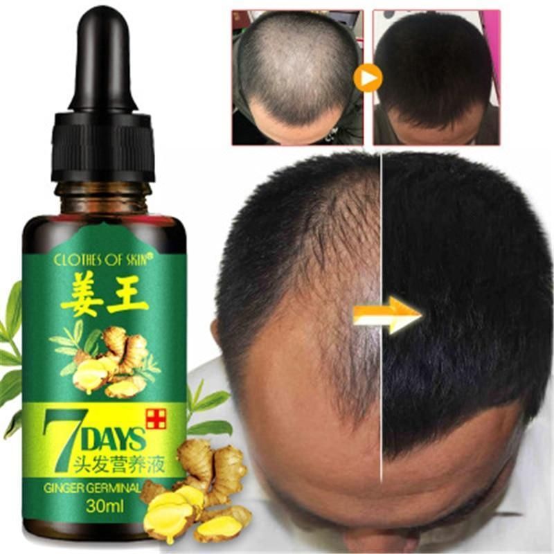 7Days Hair Regrowth Serum