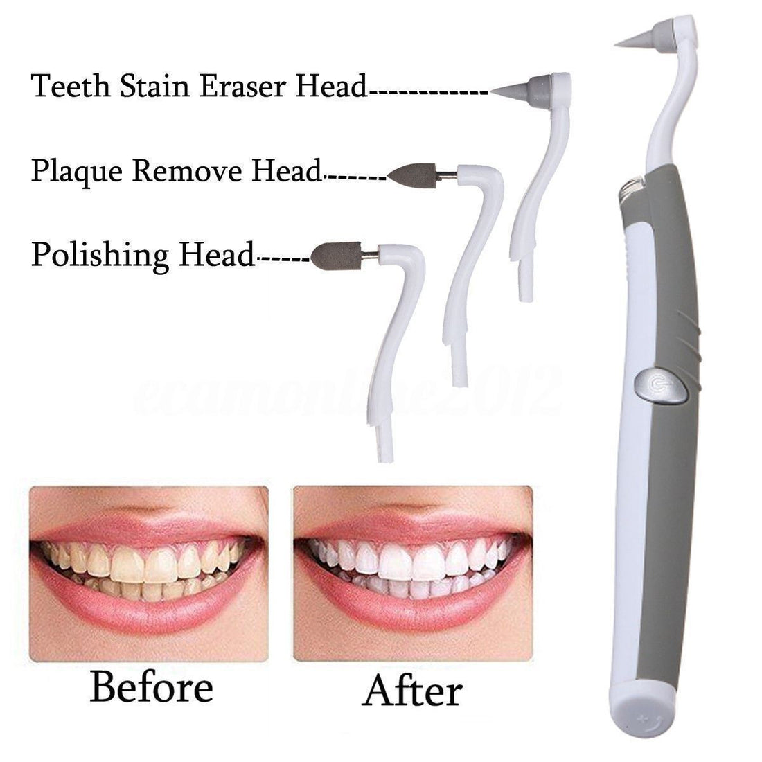Plaque Remover Tool with Sonic Vibration and LED Light 258552