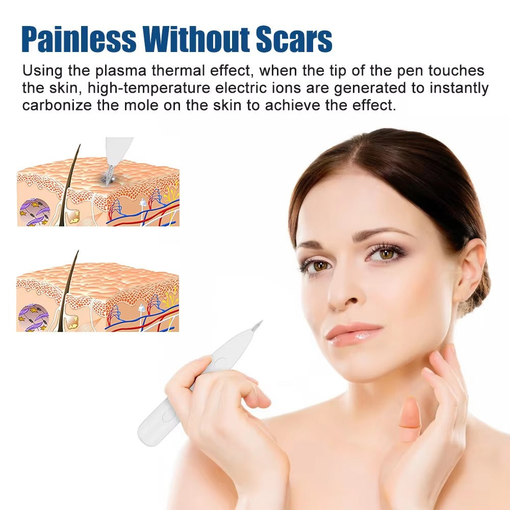 Instant Tattoo Removal Pen 250834