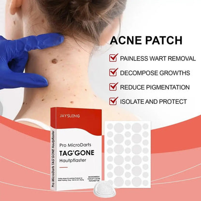Painless Micro-Patch For Skin Tag, Mole & Wart Removal 12026003226942-1