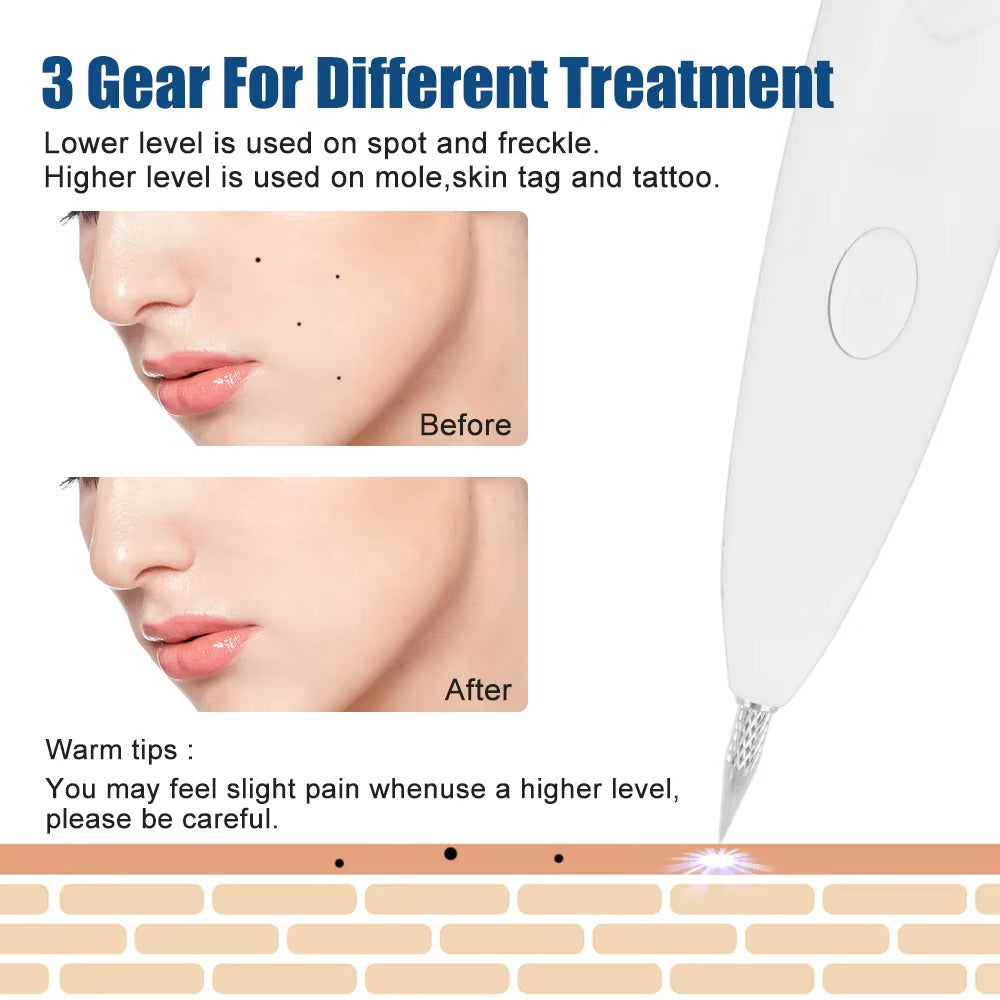 Instant Tattoo Removal Pen 250834