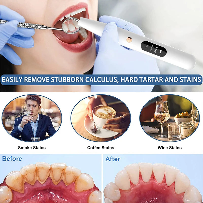 Easy Home Ultrasonic Calculus Remover Dental Scaler 8142383448264-al