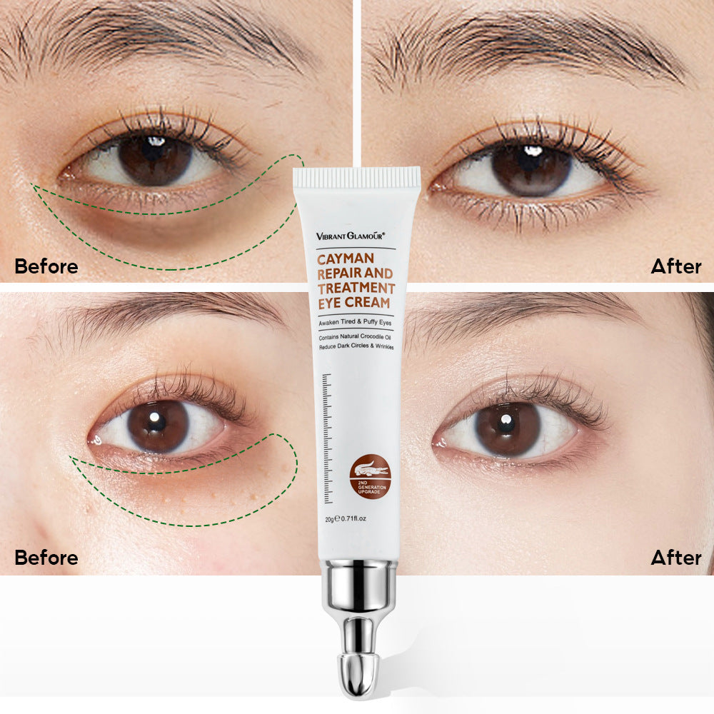 Moisturising Eye Cream for Dark Circles Wrinkles Collagen Repair Puffy Eyes 248903
