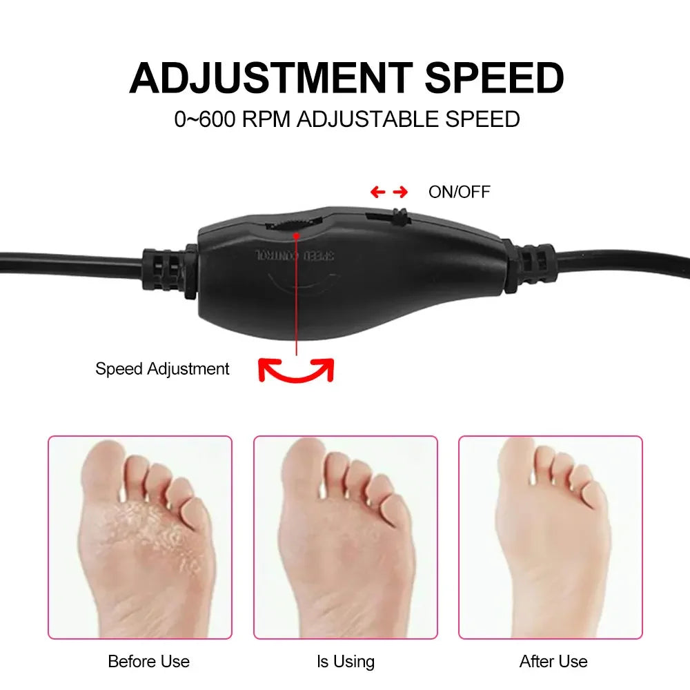 Electric Foot Callus Remover 10120200225114-1