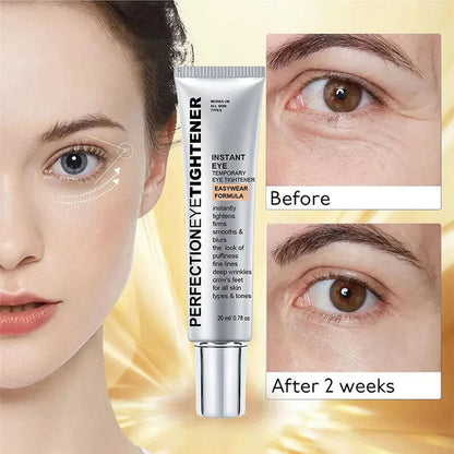Eye Tightening Cream for Reducing Puffiness Wrinkles and Brightening Tired Eyes (20g) 15170509308230-1