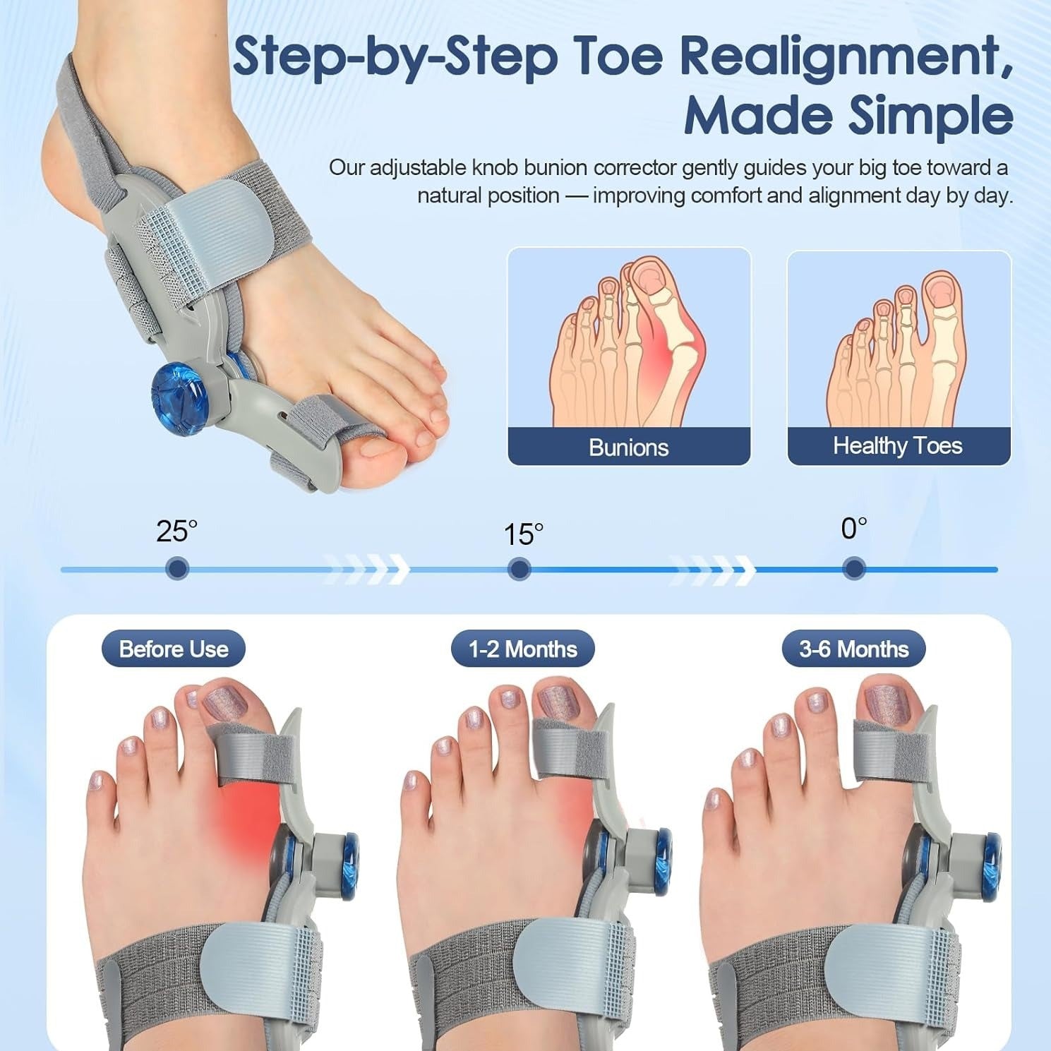 Orthopedic Toe Alignment Support Corrector Foot Pain Adjustment Brace 11588970905868-1