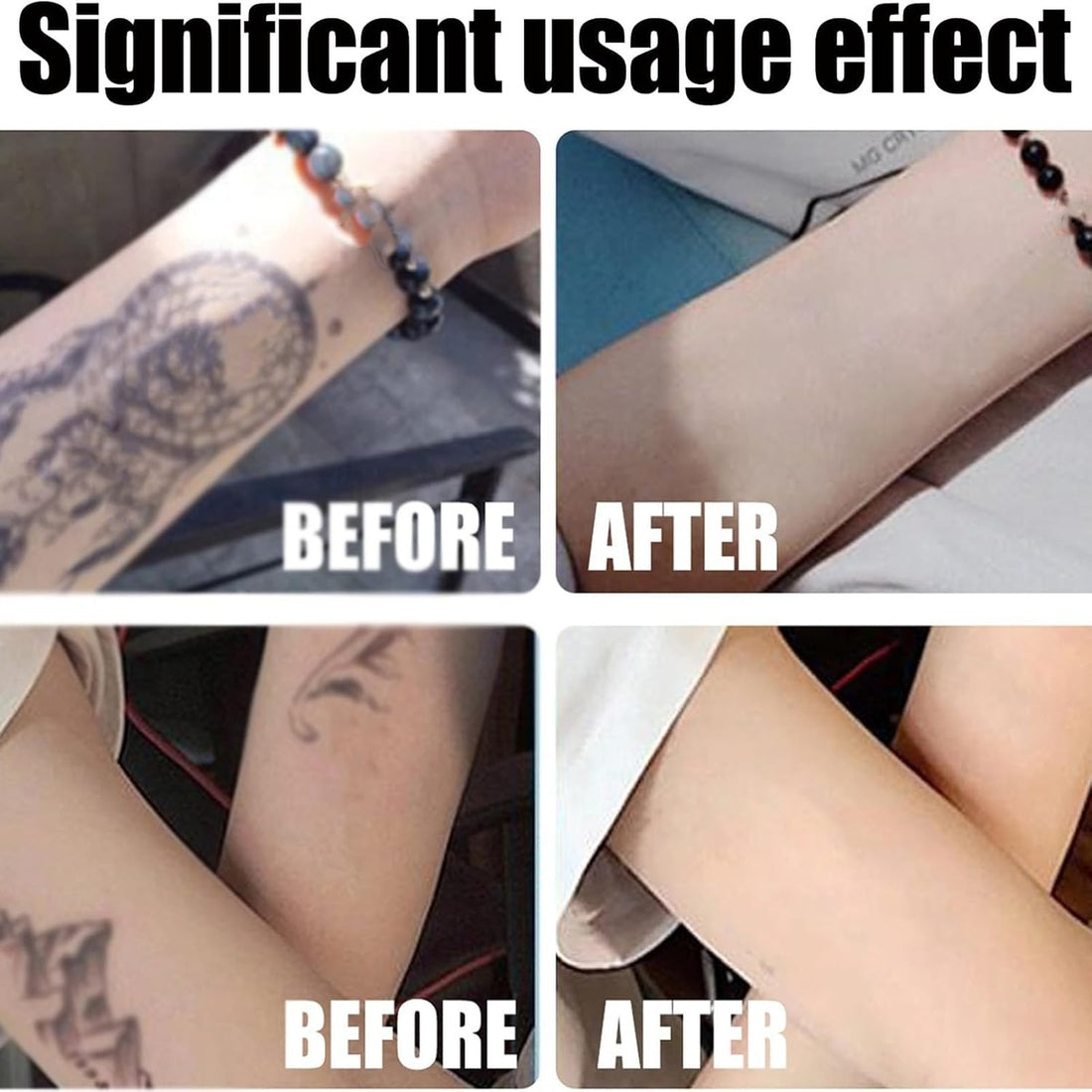 Tattoo Gone Removal Cream Fades Ink Restores Natural Clear Skin (30g) 14914338193734-1