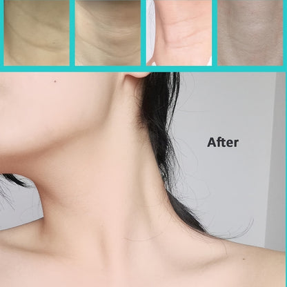 Set 20Pc Neck Lifting Tape - Instant Firming & Sculpting Effect - Invisible & Skin-Safe Adhesive 15170501607750-1