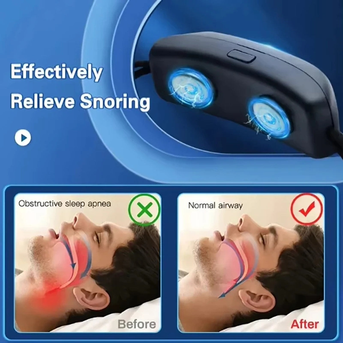 Smart Anti Snoring Device EMS Pulse Stop Snore Effective Aid for Snoring Prevention 9541692752193-1