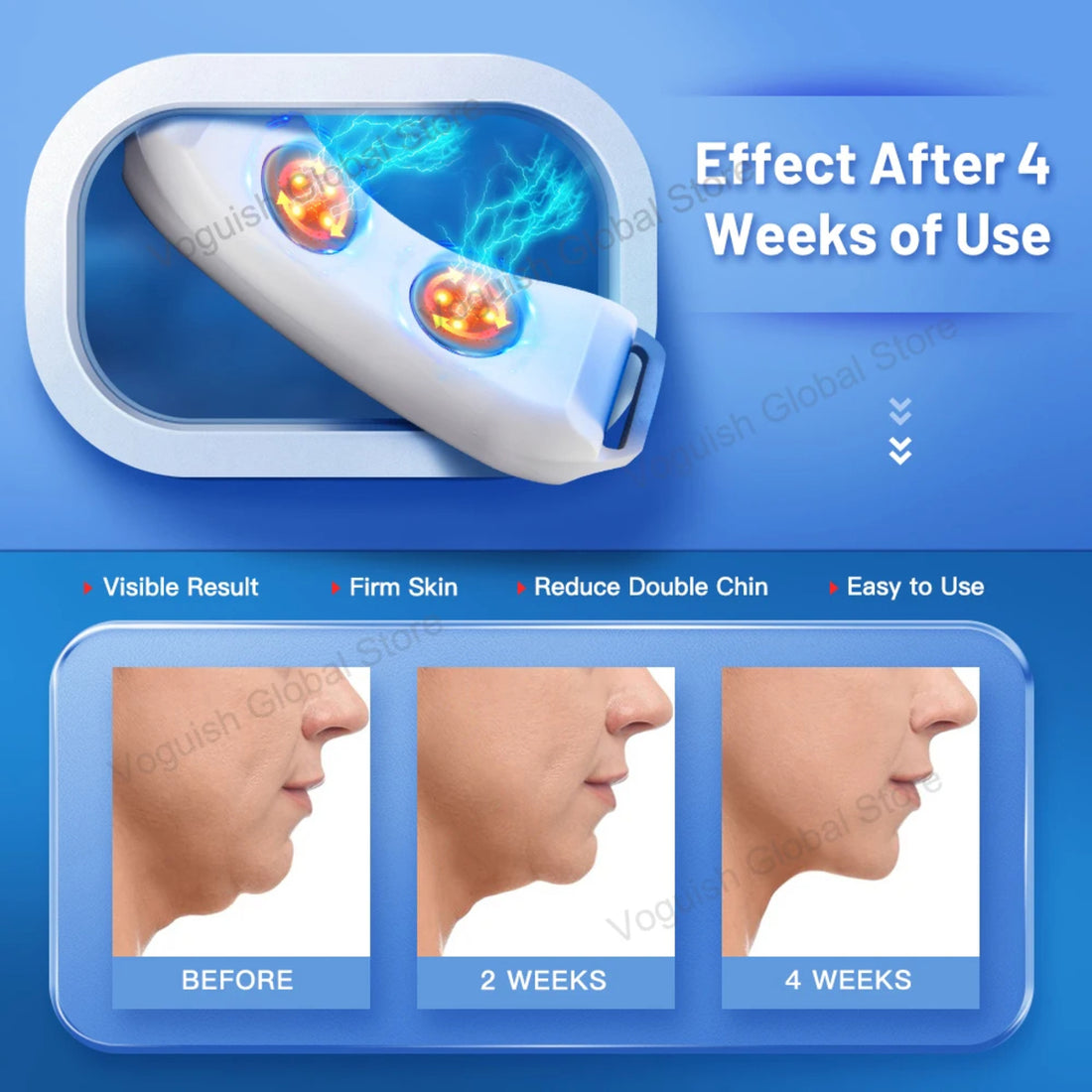 Facial Lifting Device - Jawline Shaping, Skin Firming, Custom Use Anywhere 1005005922099297-Standard Version
