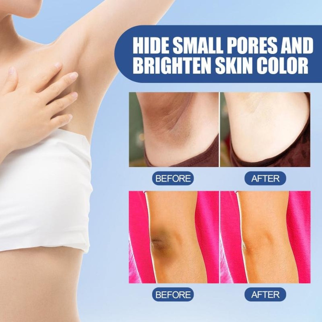 Dark Spot Whitening Body Cream for Knees, Elbows & Intimate Areas 10082387001690-1