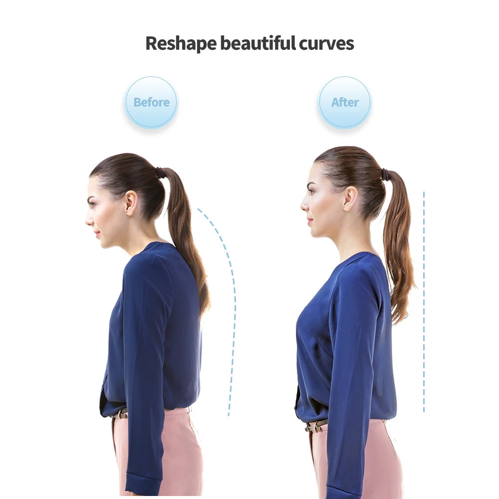 Smart Posture Corrector - Neck Hump Straightener Improve Your Posture for Adult and Kid 7914076569798-1