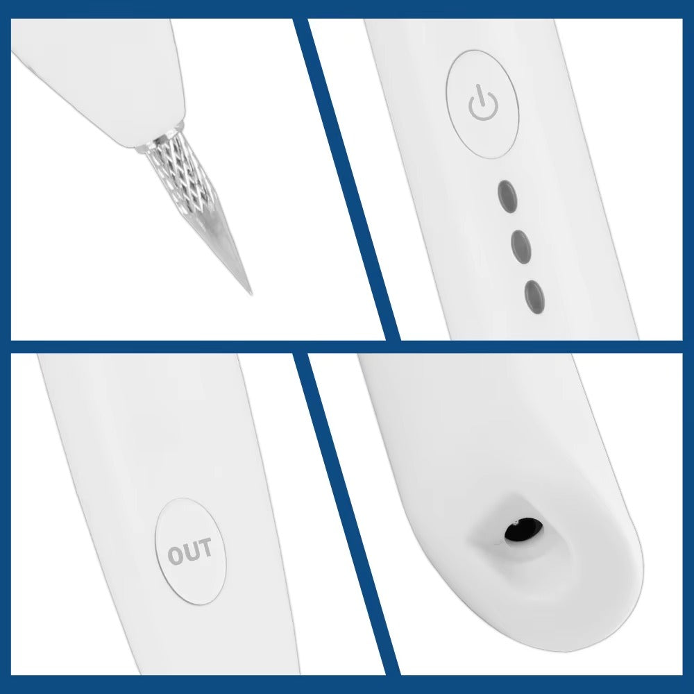 Instant Tattoo Removal Pen 250834