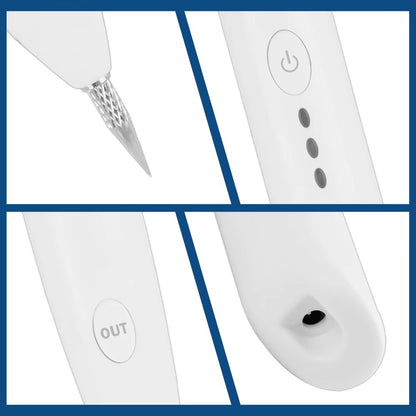 Instant Tattoo Removal Pen 250834