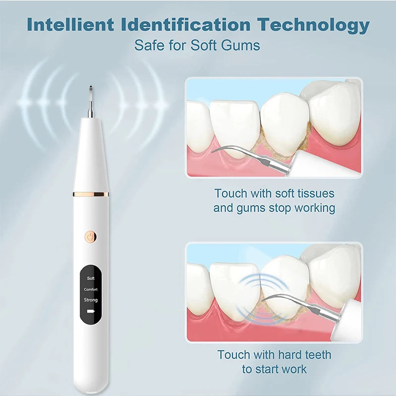 Easy Home Ultrasonic Calculus Remover Dental Scaler 8142383448264-al