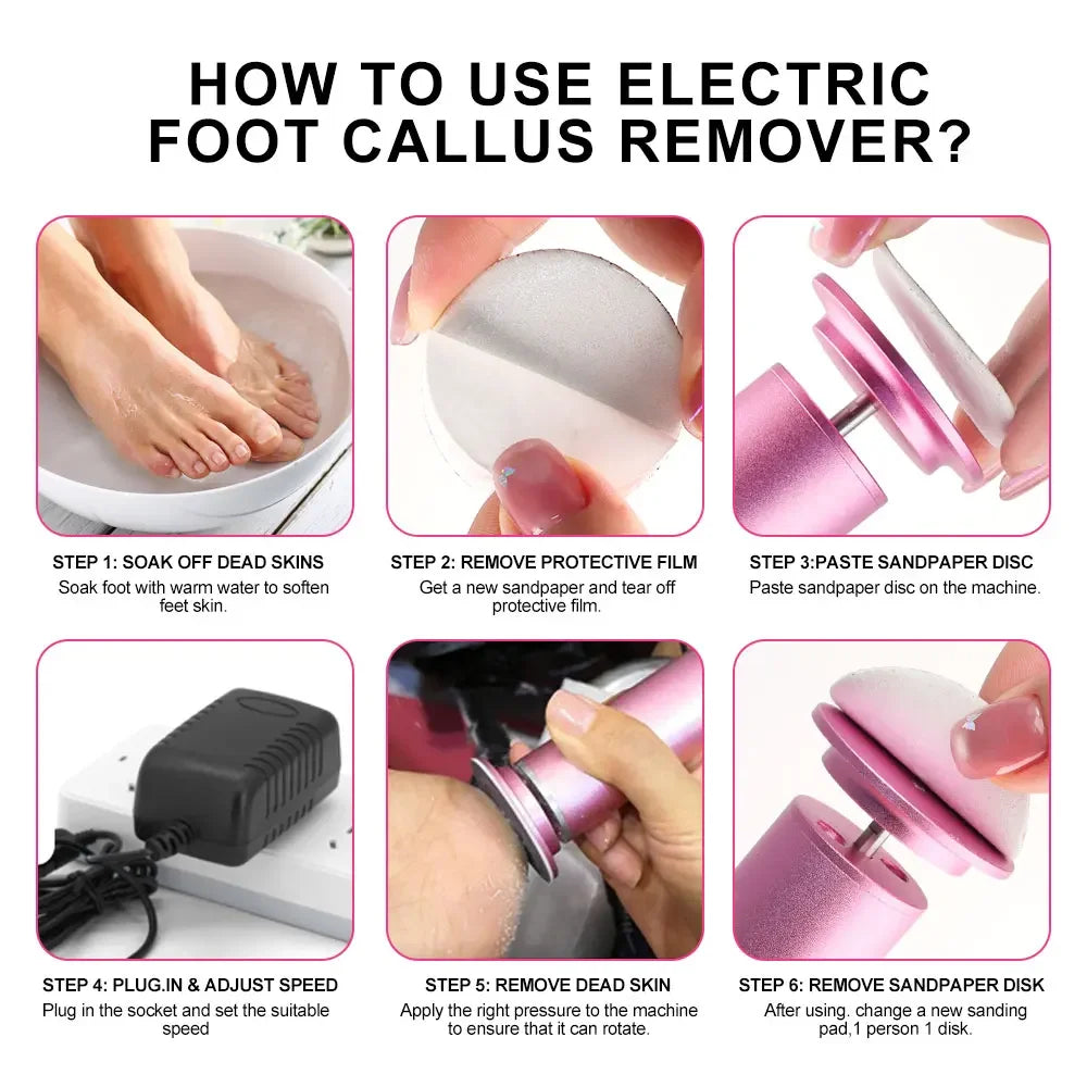Electric Foot Callus Remover 10120200225114-1