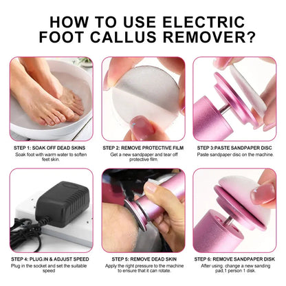 Electric Foot Callus Remover 10120200225114-1