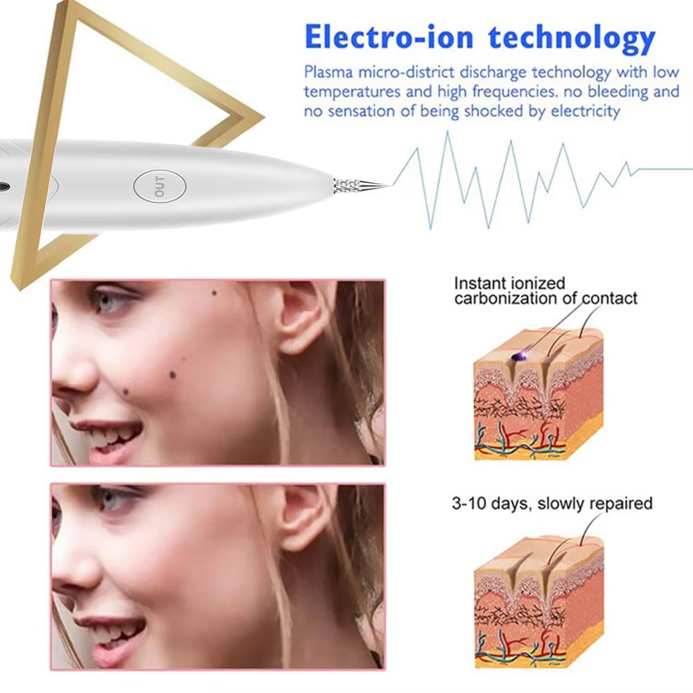 Instant Tattoo Removal Pen 250834