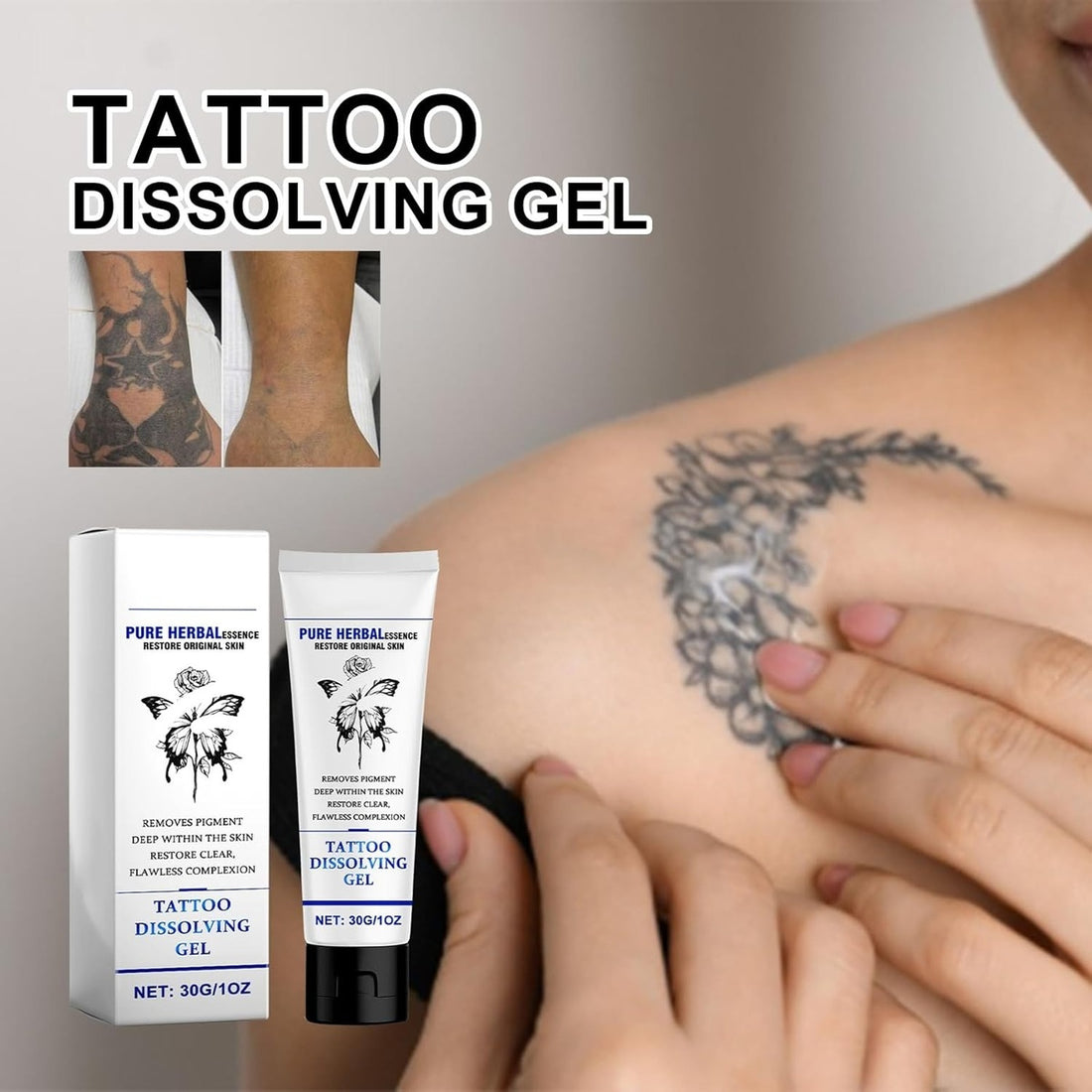 Tattoo Gone Removal Cream Fades Ink Restores Natural Clear Skin (30g) 14914338193734-1