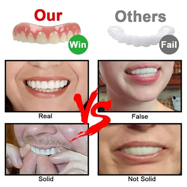 Magic Teeth Brace Veneer 249306