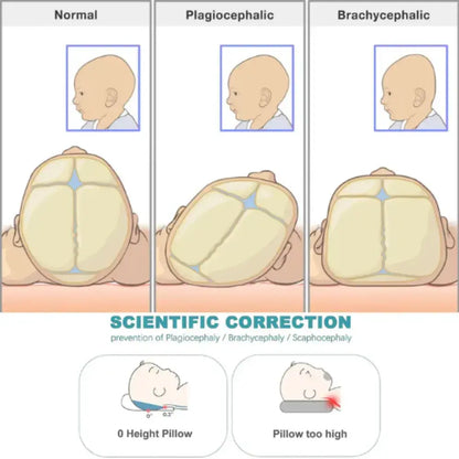 Pillow Head Shaping Prevent Flat Head For Newborn