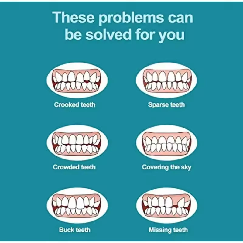 Magic Teeth Brace Veneer