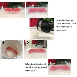 Magic Teeth Brace Veneer