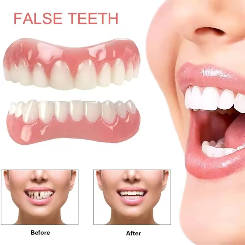 Magic Teeth Brace Veneer