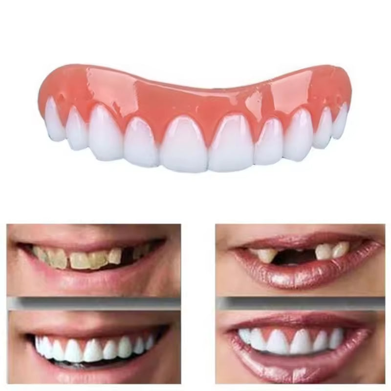 Magic Teeth Brace Veneer