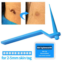 Complete Skin Tag Removal Treatment Kit (50 pcs rubber band kit)