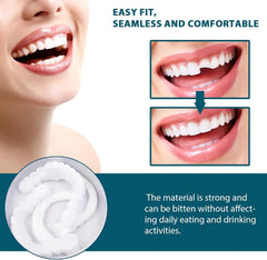 Adjustable Snap-On Denture Fit Kit