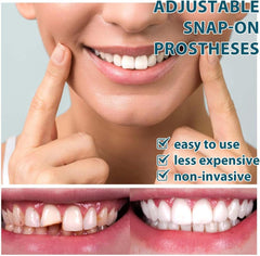 Adjustable Snap-On Denture Fit Kit