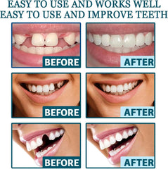 Adjustable Snap-On Denture Fit Kit