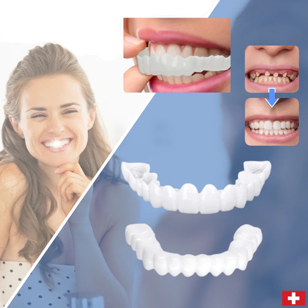 Snap-On Teeth - Always The Perfect Smile With These Veneers