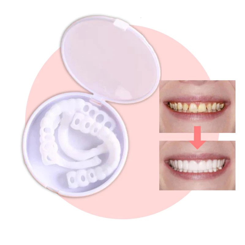 Snap-On Teeth - Always The Perfect Smile With These Veneers