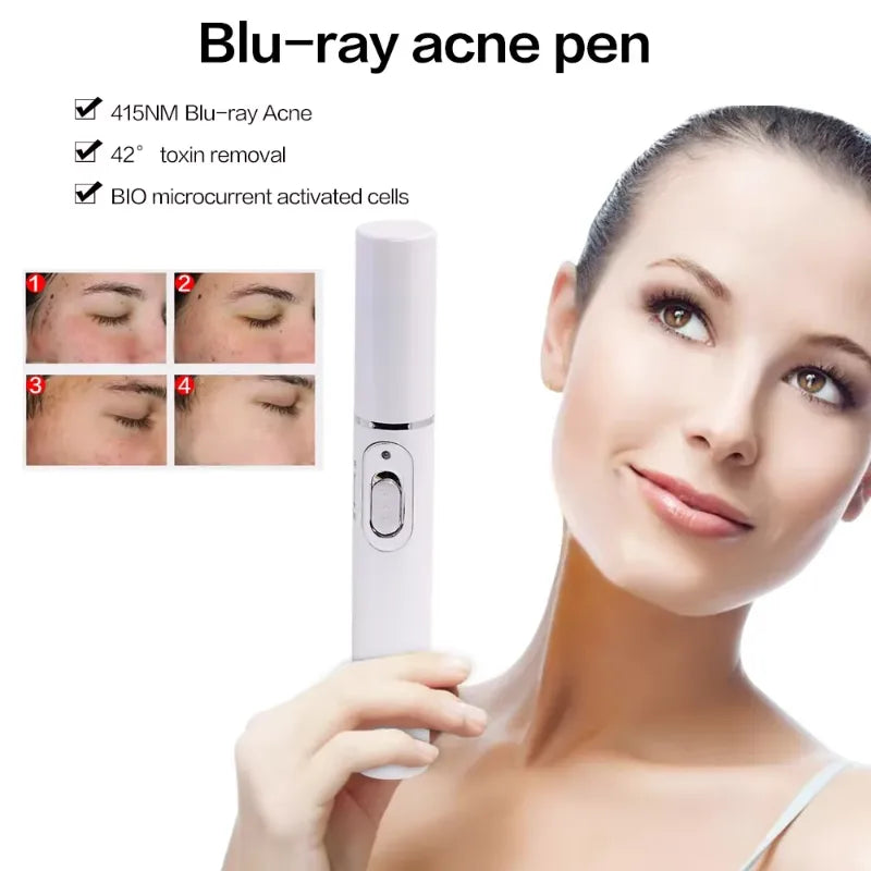 Spider Veins Removal Pen