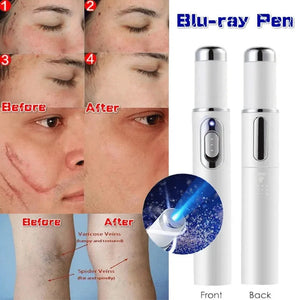 Spider Veins Removal Pen