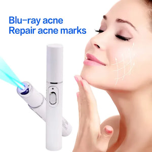 Spider Veins Removal Pen