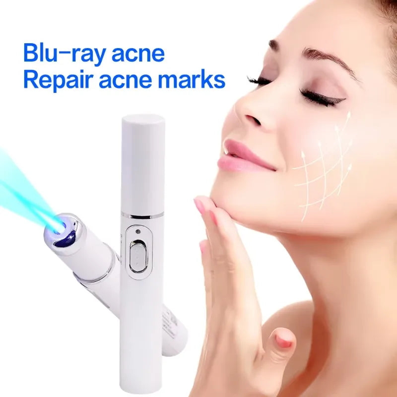 Spider Veins Removal Pen