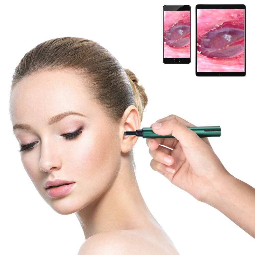 Wireless Wifi Endoscope Earwax Removal Tool With Camera | Ear Scope With Led Lights