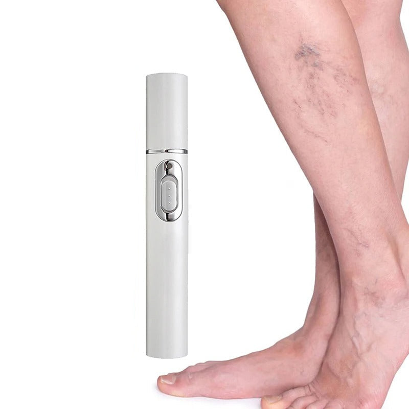 Set of 2 Varicose Spider Veins Removal Pens 250868