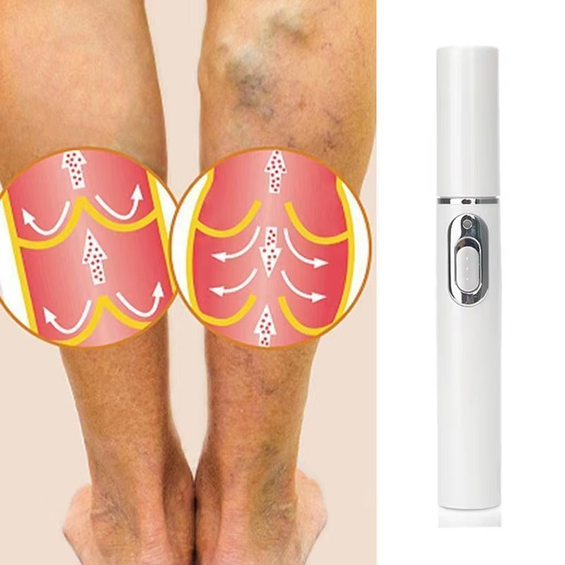 Varicose Spider Veins Removal Pen 6