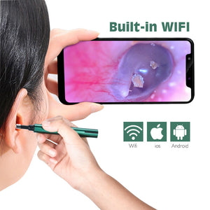 Wireless Wifi Endoscope Earwax Removal Tool With Camera | Ear Scope With Led Lights