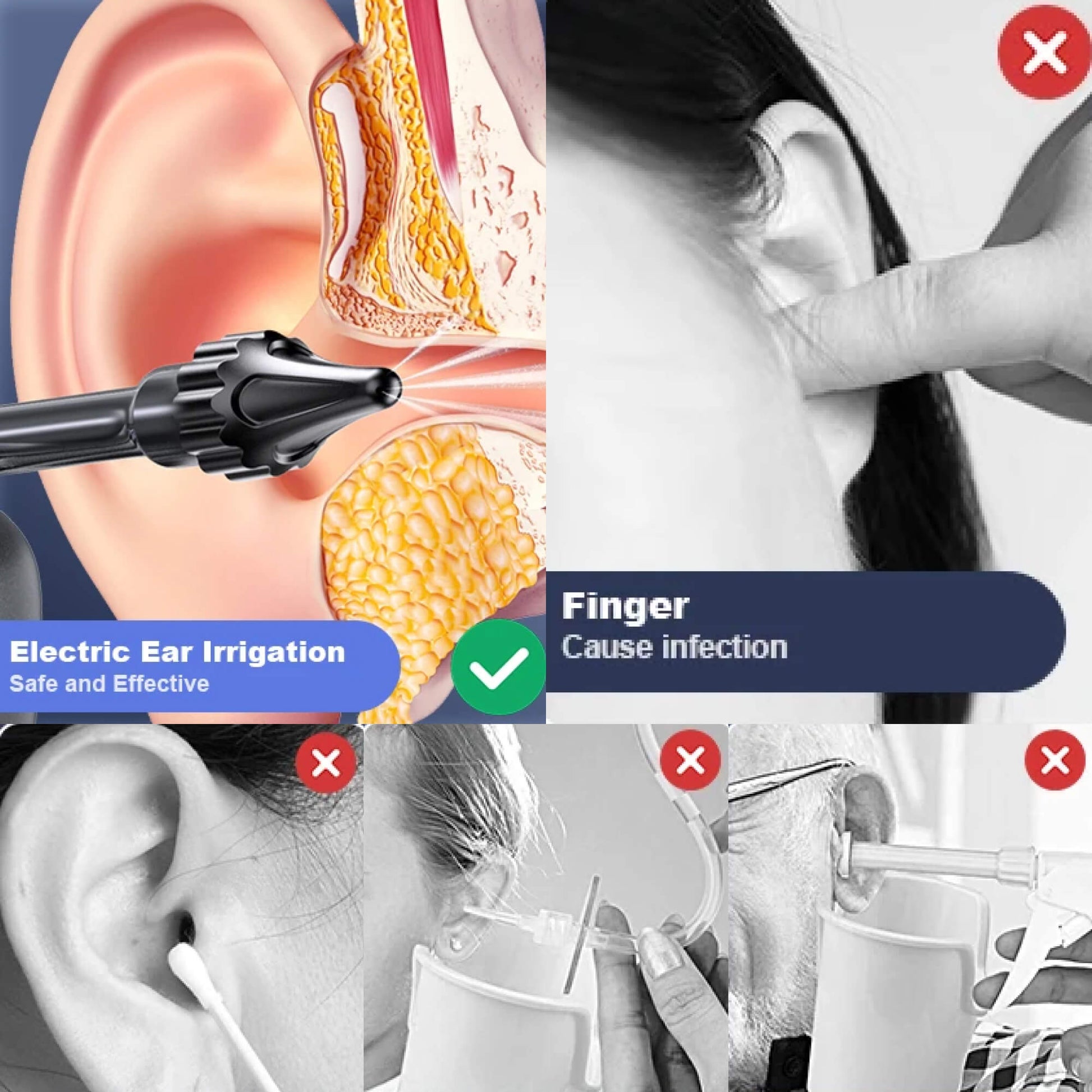 Ear Cleaner – Effective Ear Cleaning Solution for Cleaner, Healthier Ears 9840492937537-1