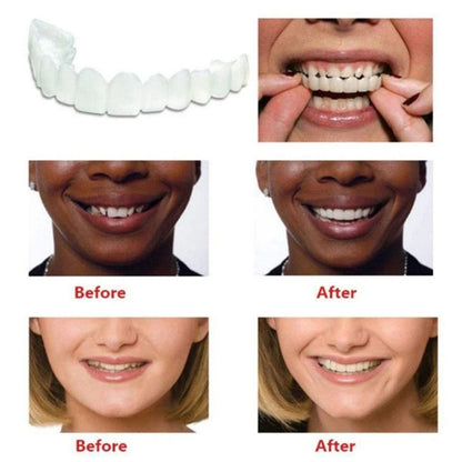 Dental Aligner For Whitening Teeth And Invisible Orthodontic Comfort 8409567821955-1
